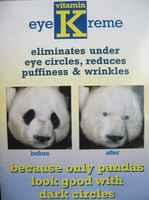 Mustat silmänympärykset