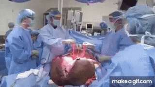 Massive 132 lbs Testicles Tumor Removal Surgery