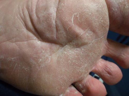 Haluaksä nuolla mun varpaita?